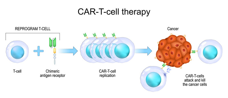 car-t-cell-therapy-cost-world.jpg